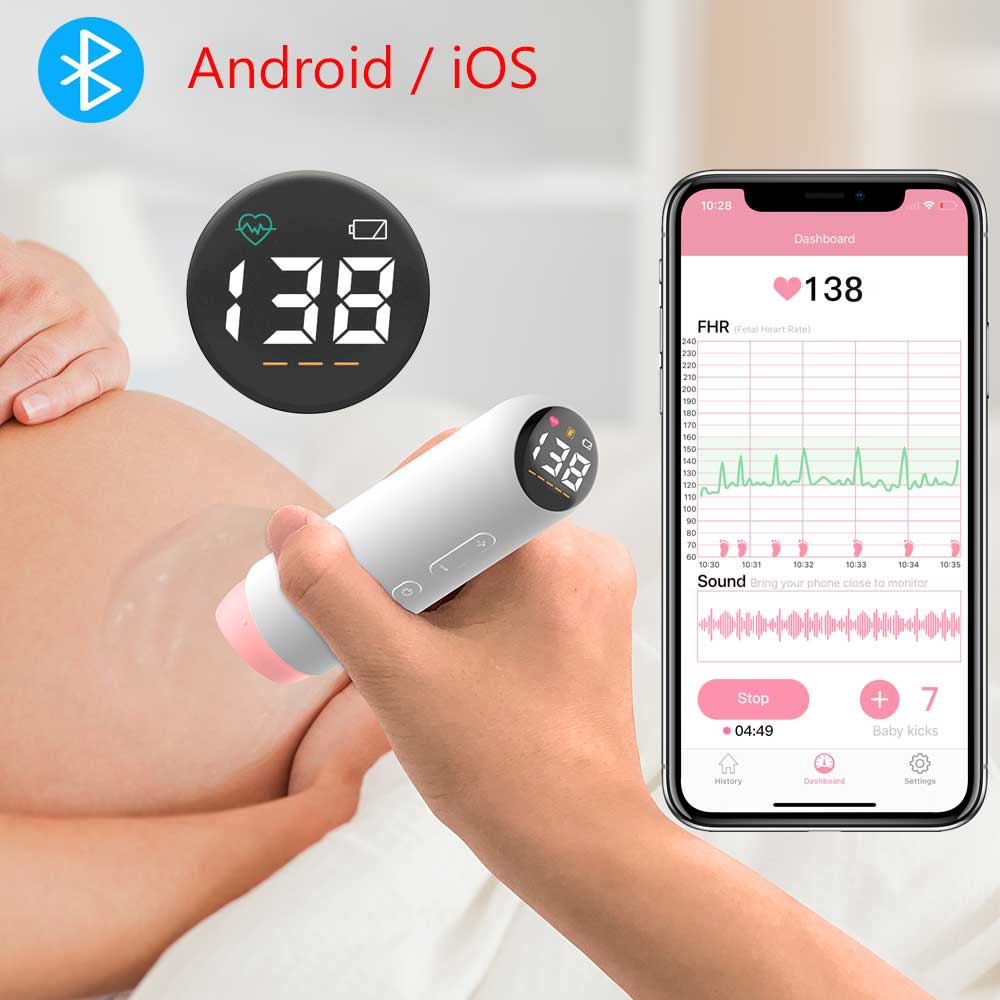 Chargeable Bluetooth Doppler Fetal Smart Fetal Heart Monitor Pregnant baby Heartbeat Data Recording LED Display Signal Detectio