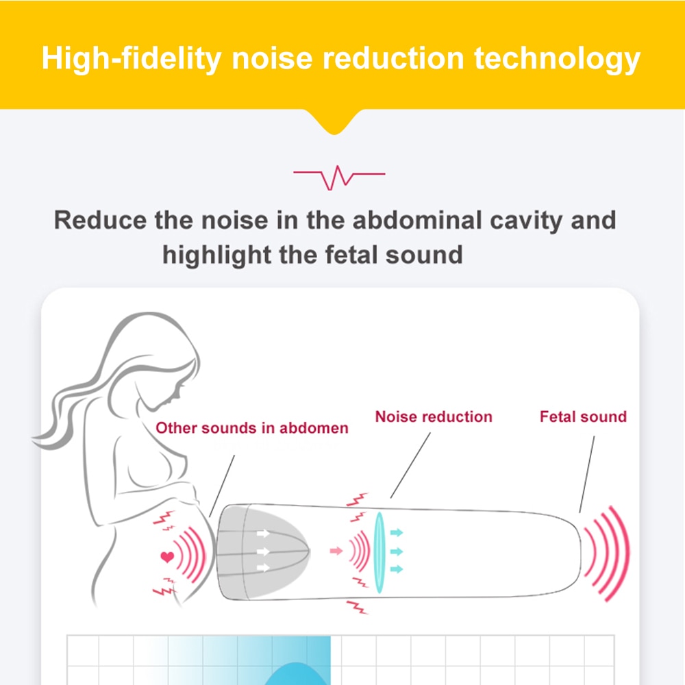 Elera Fetal Doppler Baby Monitor Portable Baby Heart Rate Detector Earphone Ultrasound Pregnant 2.5MHz No Radiation