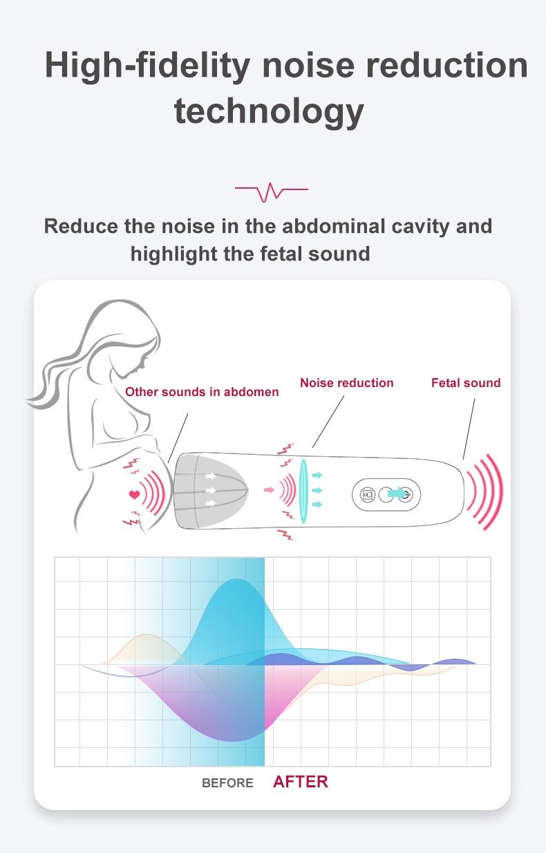 ELERA Fetal Doppler Heartbeat Detector Portable Ultrasound Pregnant Baby Heart Rate Monitor LCD 2.5MHz Pocket Vascular Doppler