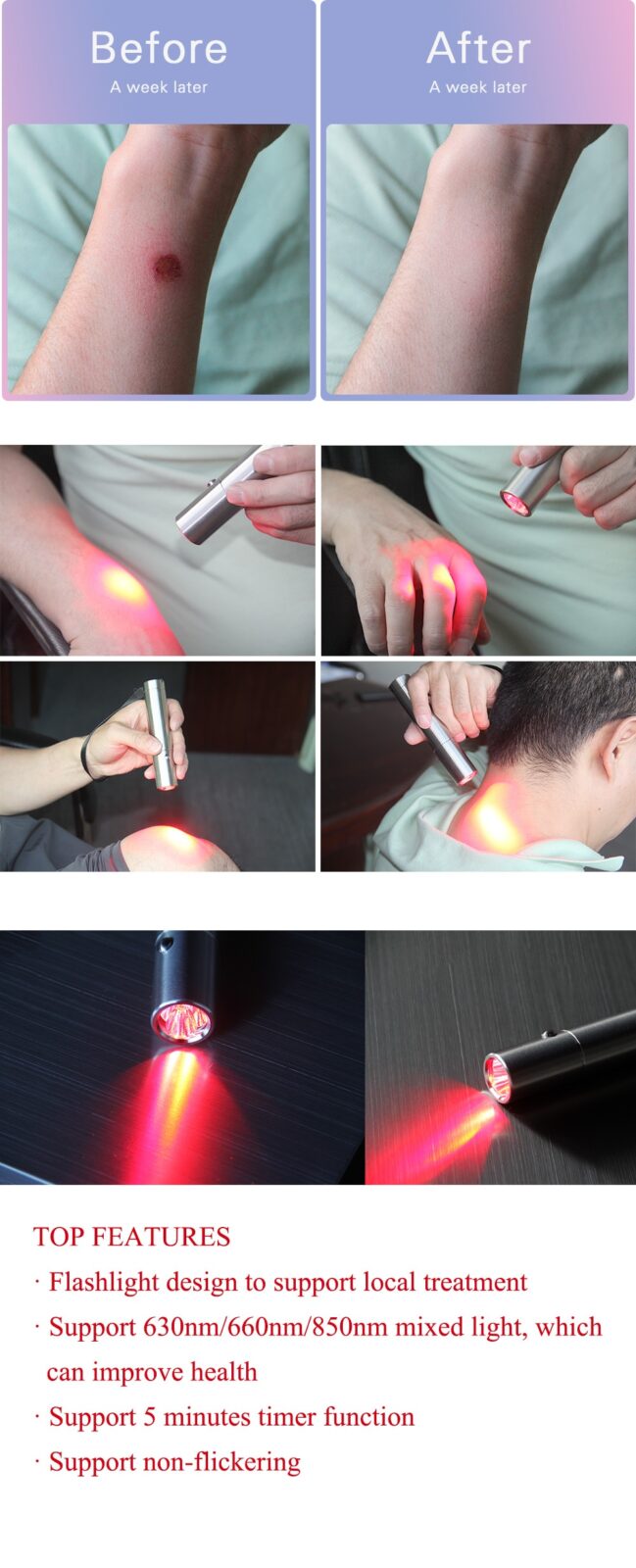 Innovative Products EMS 630nm 660nm 850nm Joint Pain LED Light Therapy Device For Low Level Light Therapy Skin Rejuvenation