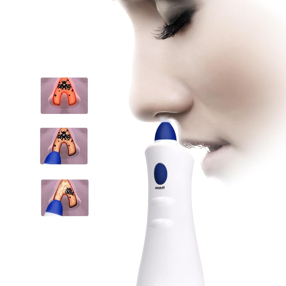 Rhinitis Allergy Reliever Massager Nasal Allergic Physiotherapy Device Nasal Congestion Sinusitis Cure Smart Snore Stopper