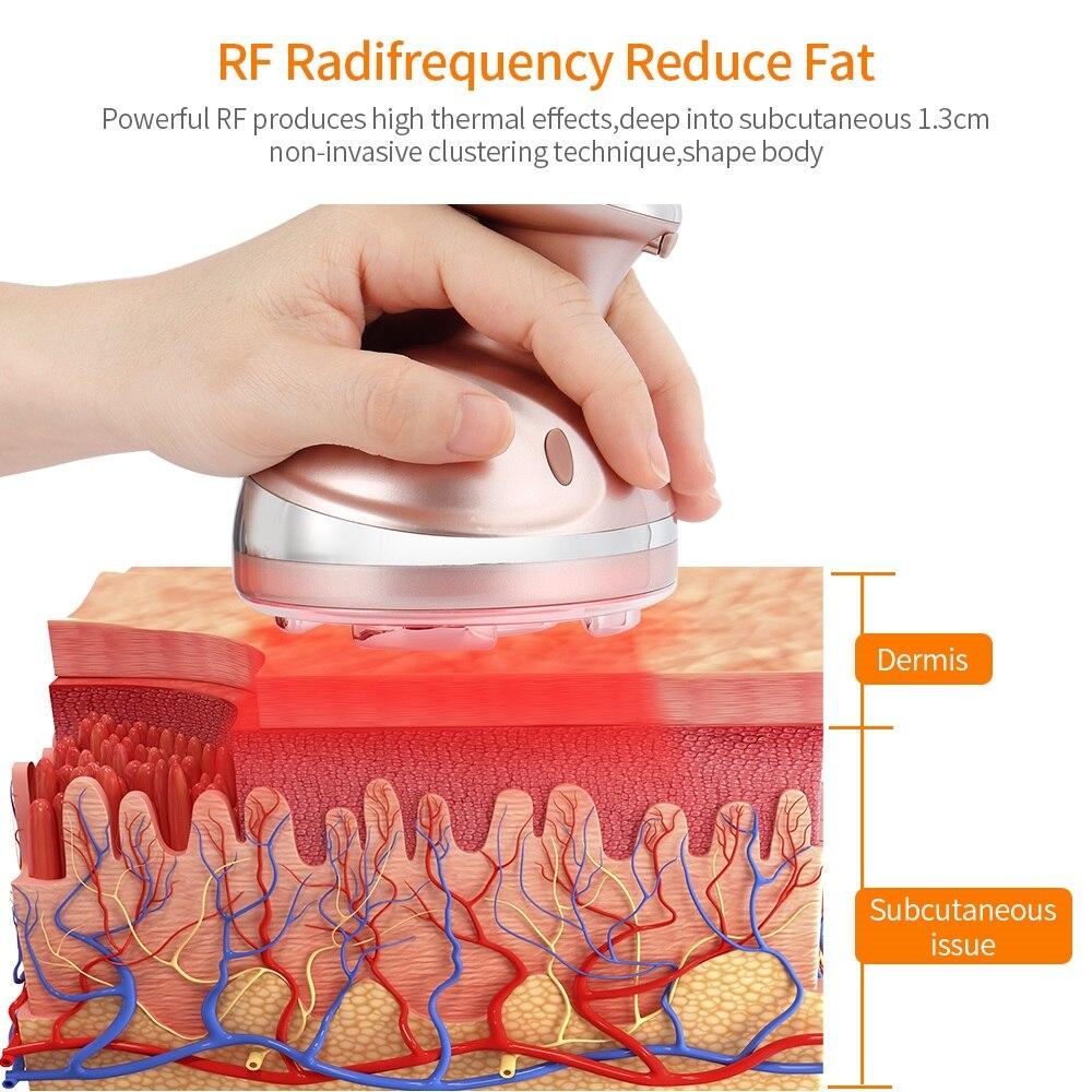 RF Slimming Massager Vibration Cavitation Ultrasonic Fat Burning Weight Loss Device High Frequency Anti Cellulite Keep Health