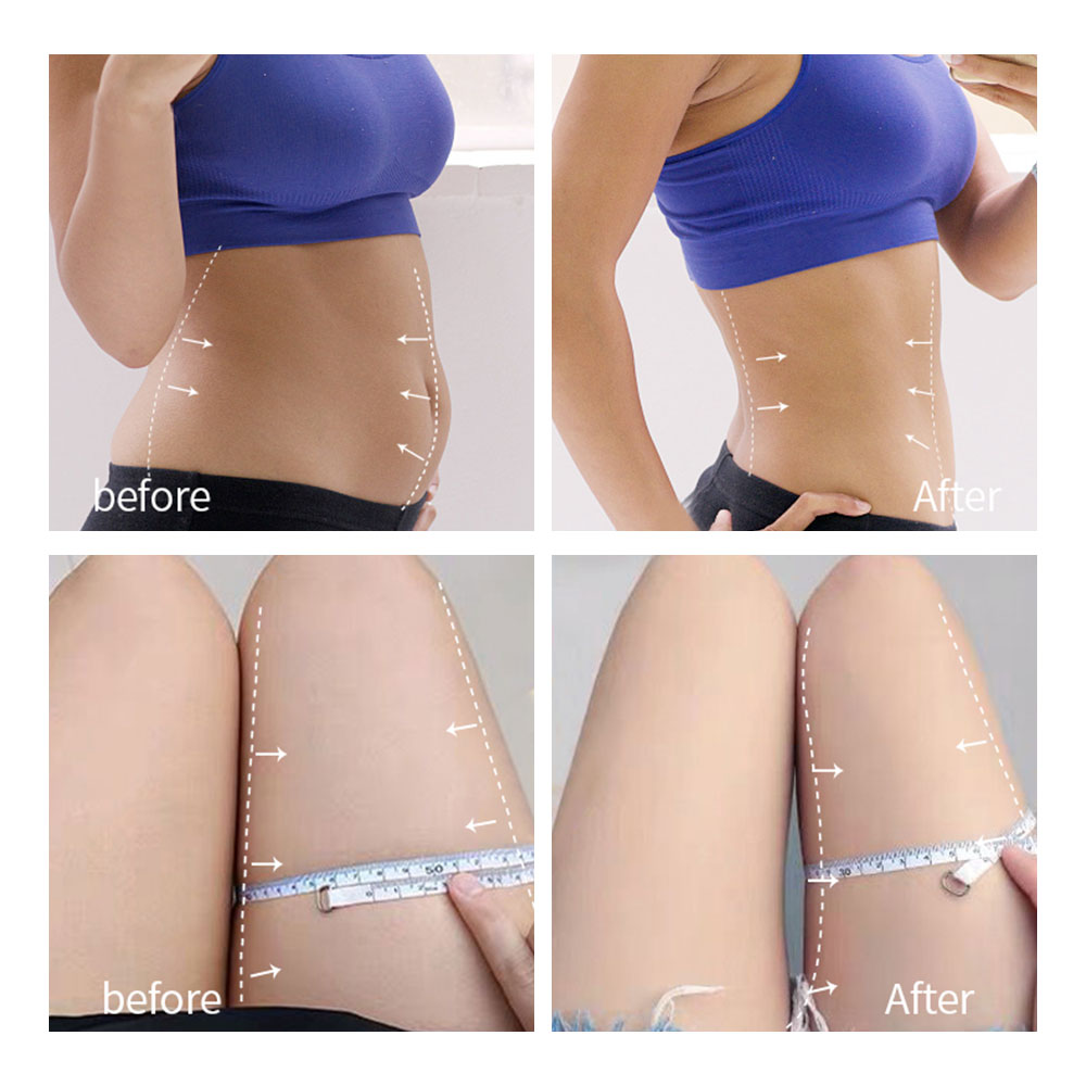 Ultrasonic Cavitation Slimming Body Massager RF Lifting Machine Weight Lose Fat Burner Radio Frequency Anti Cellulite Ultrasound