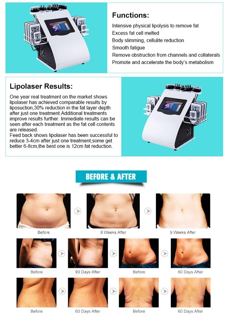 2021 Newest Fast Shipping 6 In 1 40K Ultrasonic Cavitation Vacuum Radio Frequency Laser 8 Pads Lipo Laser Slimming Machine