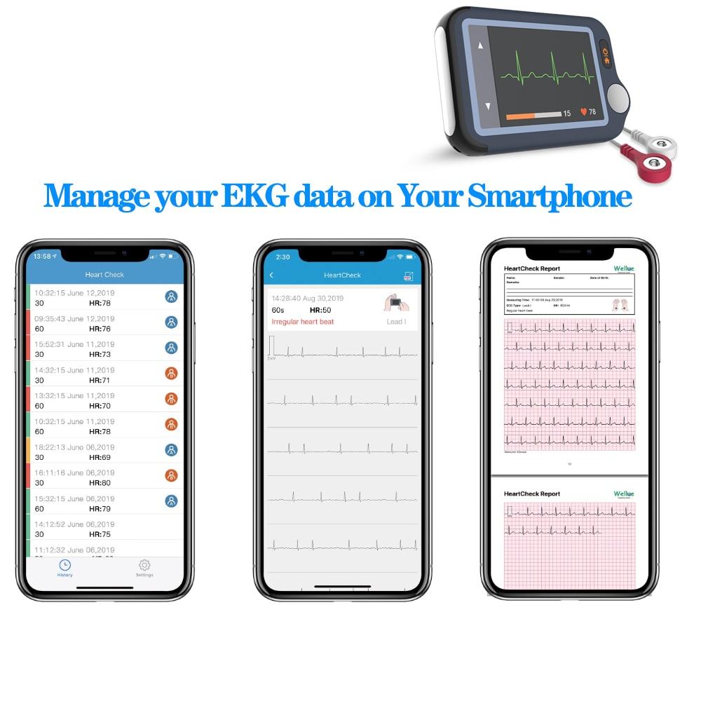 EKG Monitor Portable Heart Monitor Bluetooth ECG Machine 30s/60s/5min Historical Recording Heart Monitoring Dual User