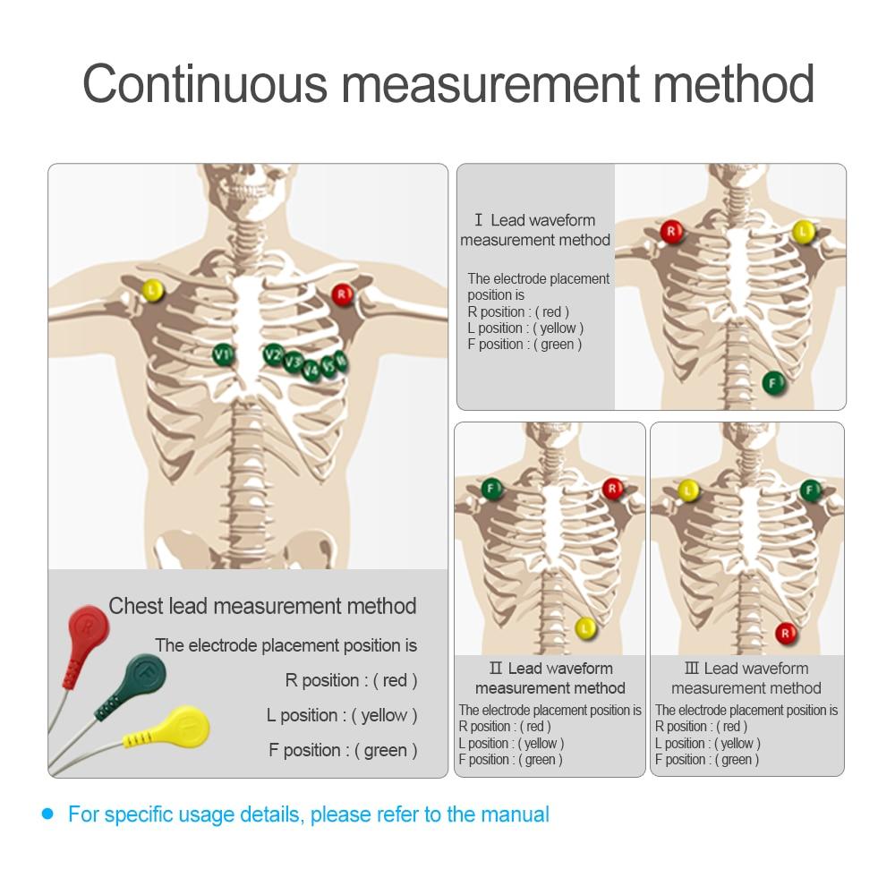 Heal Force Easy ECG Holter Monitor,Portable Household Heart EKG Handheld Heart Monitor with LCD Color Screen