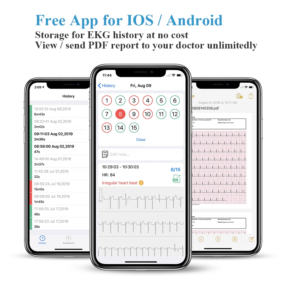 Bluetooth EKG Holter ECG With OLED Screen Wearable EKG Heart монитор Electrocardiograma Unlimited store Data Storage Share