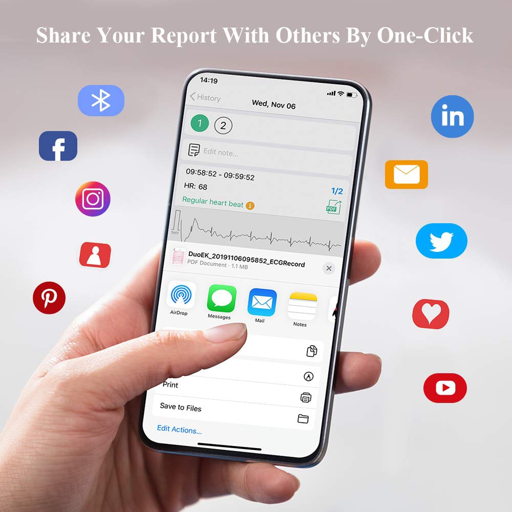 Bluetooth EKG Holter ECG With OLED Screen Wearable EKG Heart монитор Electrocardiograma Unlimited store Data Storage Share