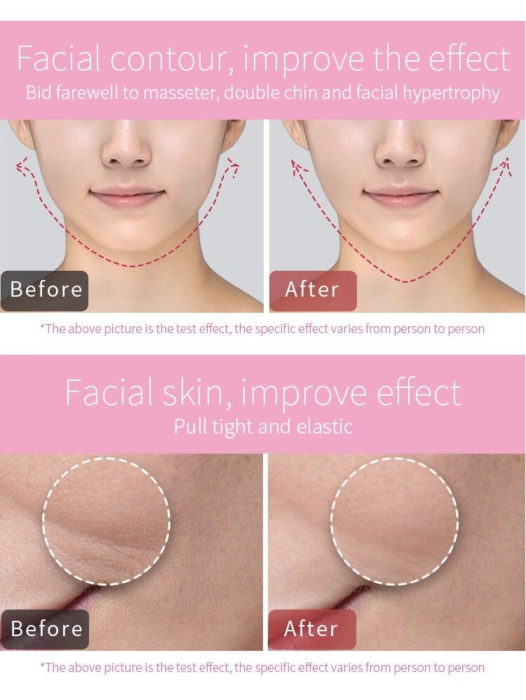 Anti-aging V-type Slimming Lifting Firming Facial Instrument Masseter Mask EMS Facial Lifter Smart Face-lifting Device Face Care