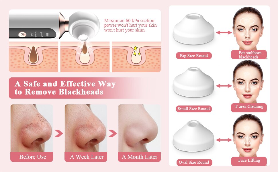 Visualized Blackhead Remover Led Fill Light Pore Cleaning, Smart Electric Home Beauty Device Remove Acne Suck Blackhead Artifact