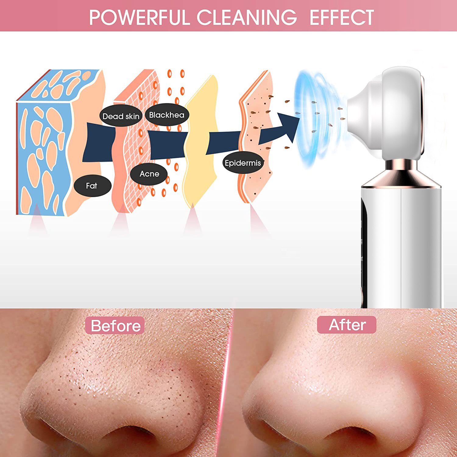 Visualized Blackhead Remover Led Fill Light Pore Cleaning, Smart Electric Home Beauty Device Remove Acne Suck Blackhead Artifact