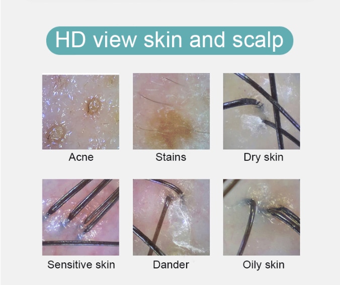 New 6 In 1 Smart Facial Cleansing Hydra-Facial Skin Analyze Deep Pore Vacuum Hydra Skin Lift Anti-aging Beauty Machine